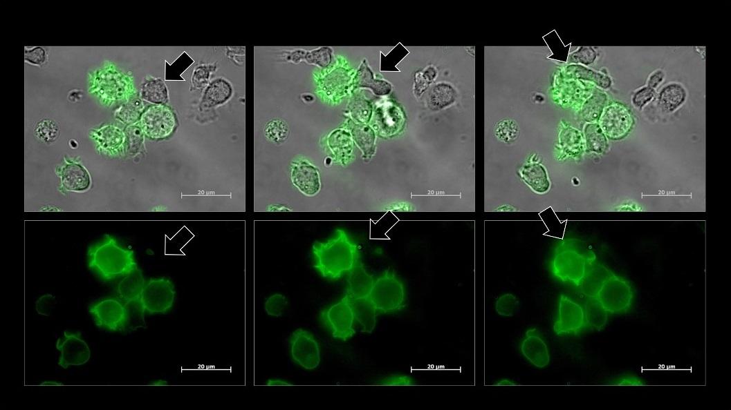 A Natural Killer cell (arrow) turns green after stealing a chunk of a green cancer cell. 
