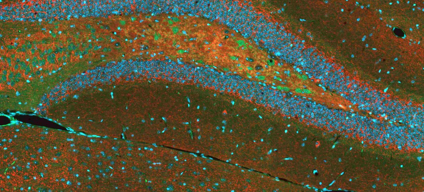 Double labelling by immunofluorescence in mouse brain