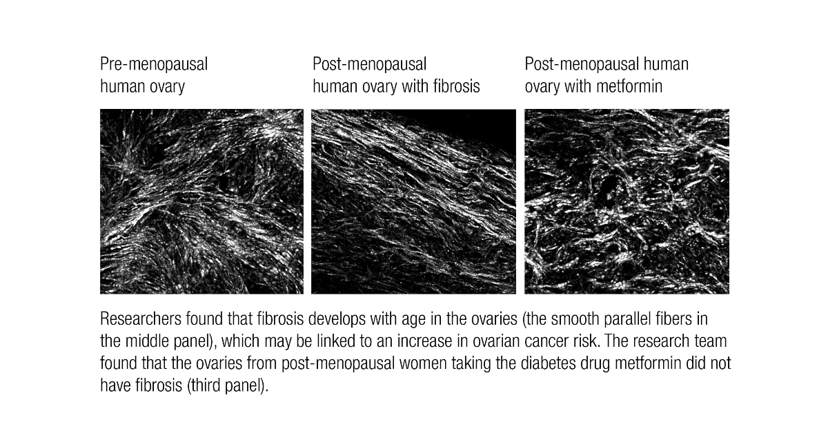 Images of various stages in the evolution of an ovary.