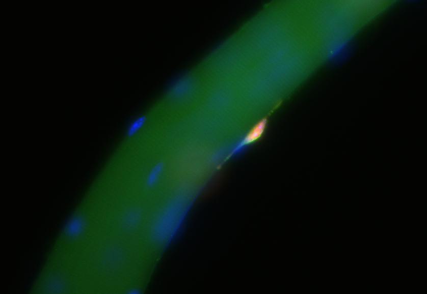 Muscle stem cell on a muscle fiber: