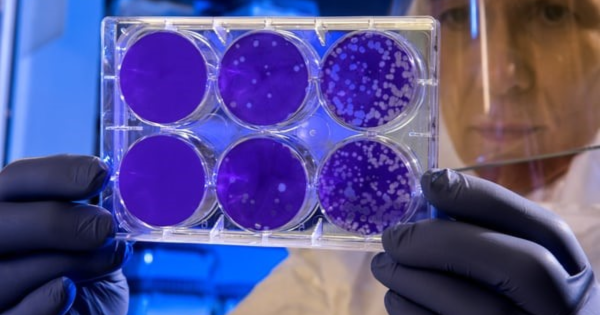 Un scientifique qui tient des récipients avec des enzymes