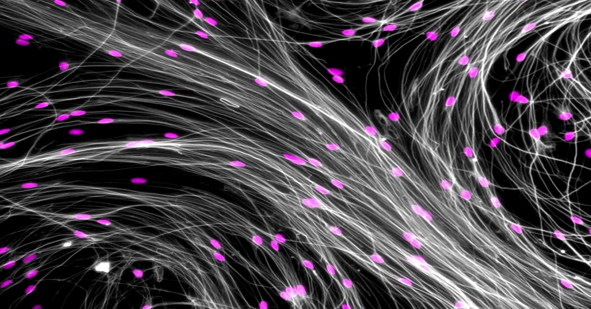 Cellules nerveuses cultivées à partir de cellules souches de la moelle épinière