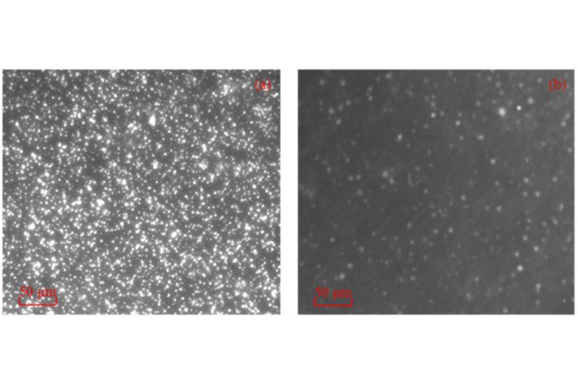 Cellules d’E. coli O157:H7