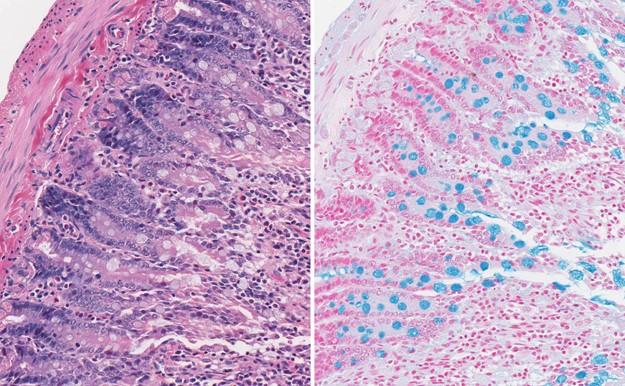 Rat intest -HE vs Alcian